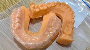 Customized Treatment