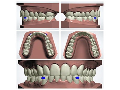 Treatment Plan Design & Review