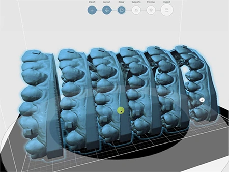 Digital Orthodontic Design Software