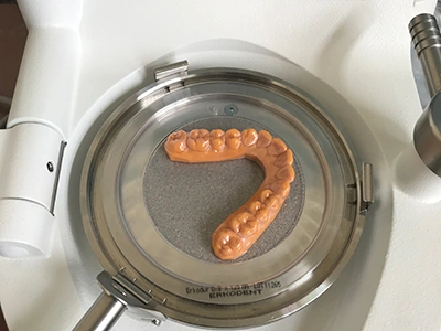 Customized Retainer Manufacturing