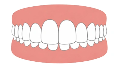Deep Bite (Overbite)