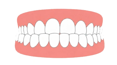 Crossbite